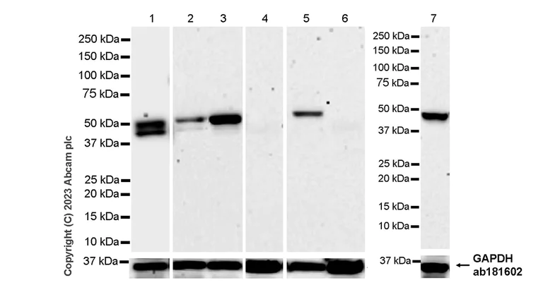 Western blot - Anti-Cytokeratin 18 antibody [RM1051] - BSA and Azide free (AB315097)