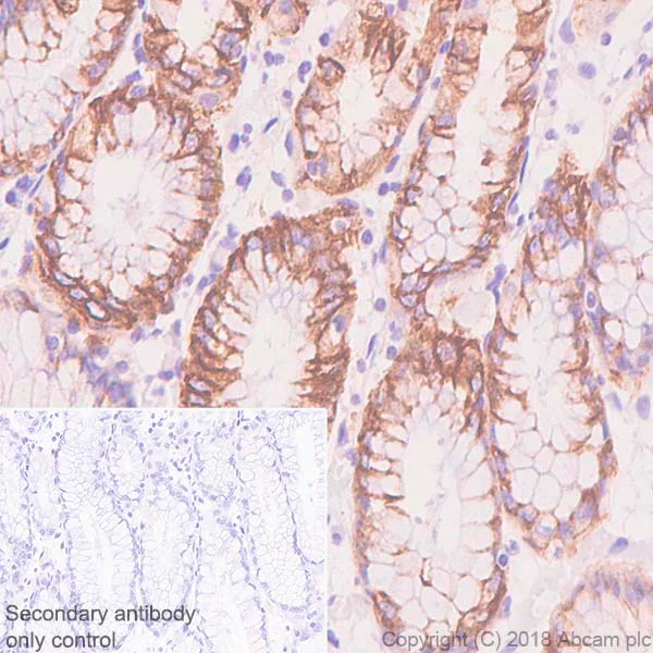 Immunohistochemistry (Formalin/PFA-fixed paraffin-embedded sections) - Anti-Cytokeratin 18 antibody [SP69] (AB93741)