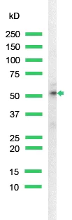 Western blot - Anti-Cytokeratin 18 antibody [SP69] (AB93741)