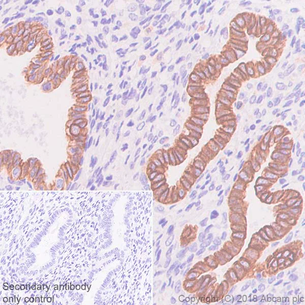 Immunohistochemistry (Formalin/PFA-fixed paraffin-embedded sections) - Anti-Cytokeratin 18 antibody [SP69] - BSA and Azide free (AB198380)