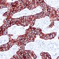 Immunohistochemistry (Formalin/PFA-fixed paraffin-embedded sections) - Anti-Cytokeratin 18 antibody [SP69] - BSA and Azide free (AB198380)