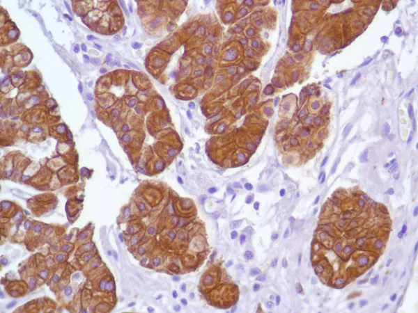 Immunohistochemistry (Formalin/PFA-fixed paraffin-embedded sections) - Anti-Cytokeratin 18 antibody [SP69] - BSA and Azide free (AB198380)