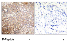 Immunohistochemistry (Formalin/PFA-fixed paraffin-embedded sections) - Anti-Cytokeratin 18 (phospho S33) antibody (AB75747)
