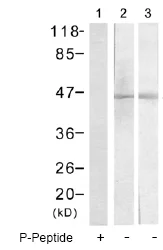 Western blot - Anti-Cytokeratin 18 (phospho S33) antibody (AB75747)