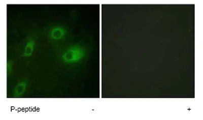 Immunocytochemistry/ Immunofluorescence - Anti-Cytokeratin 18 (phospho S52) antibody (AB63393)