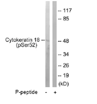 Western blot - Anti-Cytokeratin 18 (phospho S52) antibody (AB63393)