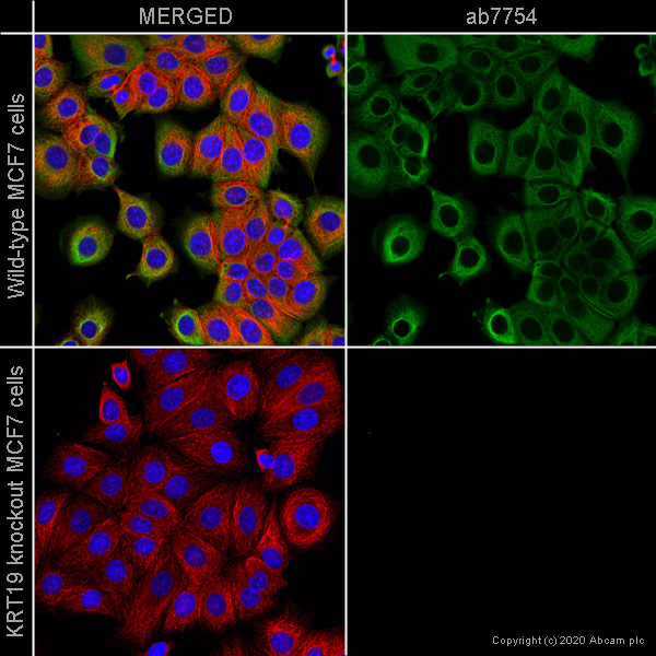 Immunocytochemistry - Anti-Cytokeratin 19 antibody [A53-B/A2] - Cytoskeleton Marker (AB7754), expandable thumbnail