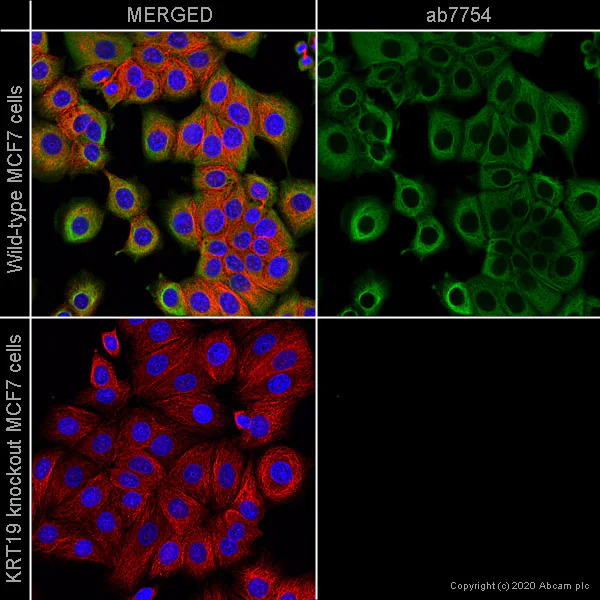 Immunocytochemistry - Anti-Cytokeratin 19 antibody [A53-B/A2] - Cytoskeleton Marker (AB7754)