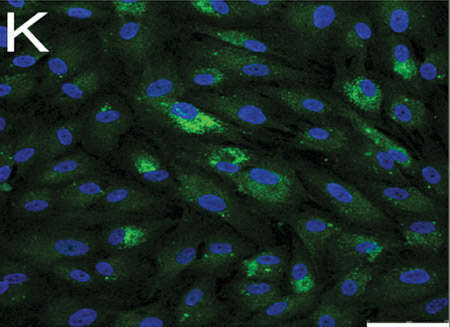 Immunocytochemistry/ Immunofluorescence - Anti-Cytokeratin 19 antibody [A53-B/A2] - Cytoskeleton Marker (AB7754), expandable thumbnail