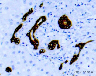 Immunohistochemistry (Formalin/PFA-fixed paraffin-embedded sections) - Anti-Cytokeratin 19 antibody [A53-B/A2] - Cytoskeleton Marker (ab7754), expandable thumbnail
