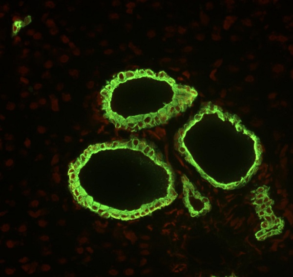 Immunohistochemistry (Formalin/PFA-fixed paraffin-embedded sections) - Anti-Cytokeratin 19 antibody [A53-B/A2] - Cytoskeleton Marker (AB7754), expandable thumbnail