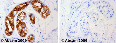 Immunohistochemistry (Formalin/PFA-fixed paraffin-embedded sections) - Anti-Cytokeratin 19 antibody [A53-B/A2] - Cytoskeleton Marker (AB7754)