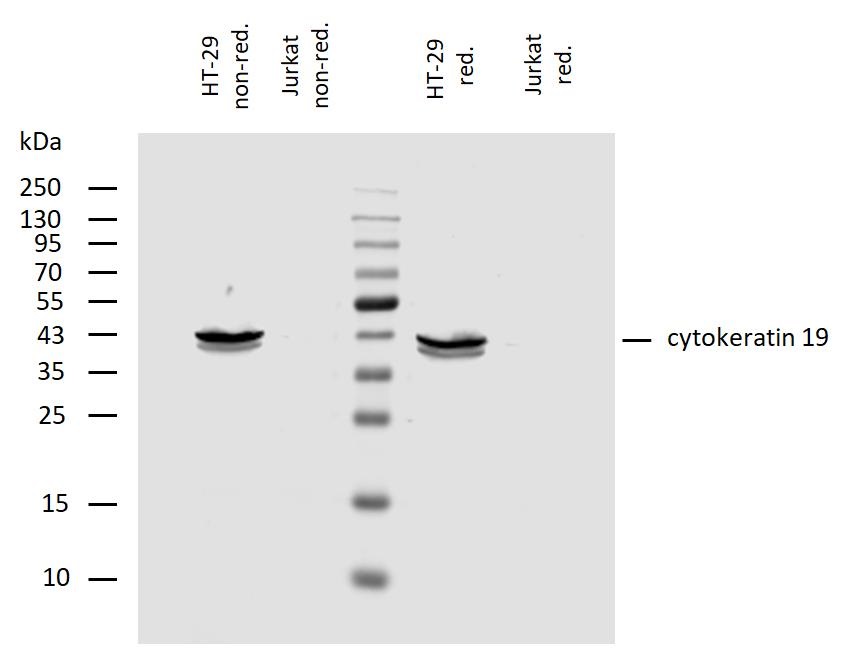 Western blot - Anti-Cytokeratin 19 antibody [A53-B/A2] - Cytoskeleton Marker (AB7754), expandable thumbnail