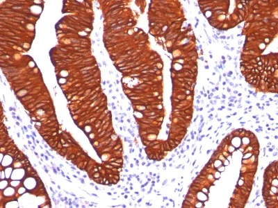 Immunohistochemistry (Formalin/PFA-fixed paraffin-embedded sections) - Anti-Cytokeratin 19 antibody [A53-B/A2.26] - BSA and Azide free (AB212566)