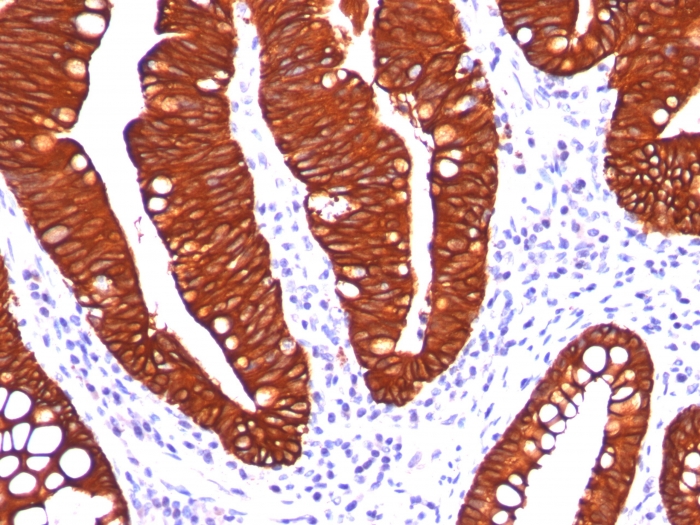 Immunohistochemistry (Formalin/PFA-fixed paraffin-embedded sections) - Anti-Cytokeratin 19 antibody [A53-B] (AB194399)