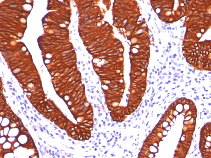 Immunohistochemistry (Formalin/PFA-fixed paraffin-embedded sections) - Anti-Cytokeratin 19 antibody [A53-B] (AB194399)