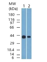 Western blot - Anti-Cytokeratin 19 antibody [A53-B] (AB194399)