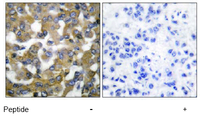 Immunohistochemistry (Formalin/PFA-fixed paraffin-embedded sections) - Anti-Cytokeratin 19 antibody (AB53119), expandable thumbnail