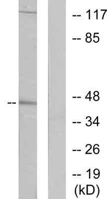 Western blot - Anti-Cytokeratin 19 antibody (AB53119)