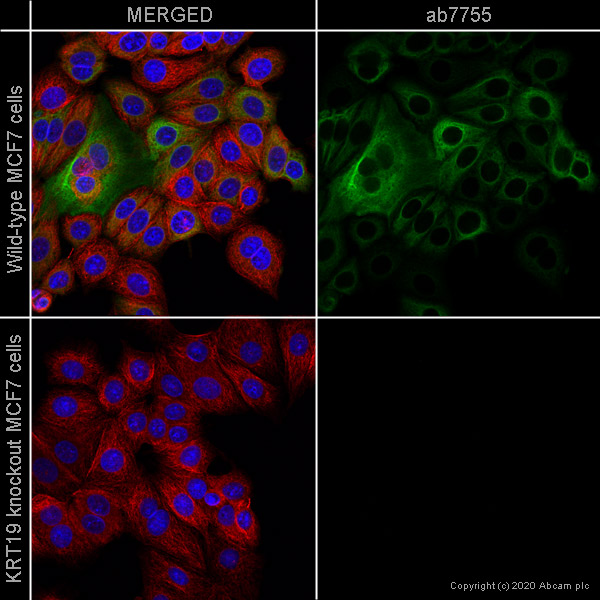 Anti-Cytokeratin 19 antibody [BA-17]
