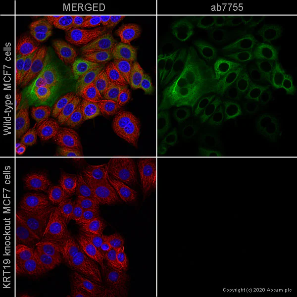 Immunocytochemistry - Anti-Cytokeratin 19 antibody [BA-17] (AB7755)