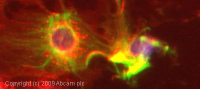 Immunocytochemistry/ Immunofluorescence - Anti-Cytokeratin 19 antibody [BA-17] (AB7755)