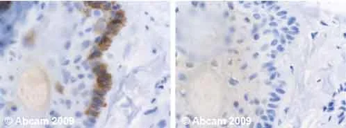 Immunohistochemistry (Formalin/PFA-fixed paraffin-embedded sections) - Anti-Cytokeratin 19 antibody [BA-17] (AB7755)