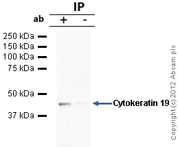 Immunoprecipitation - Anti-Cytokeratin 19 antibody [BA-17] (AB7755)