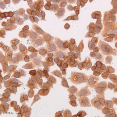 Immunocytochemistry - Anti-Cytokeratin 19 antibody [BA16] (AB20210)