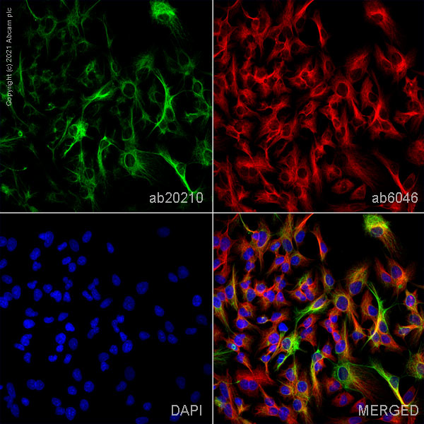 Immunocytochemistry/ Immunofluorescence - Anti-Cytokeratin 19 antibody [BA16] (AB20210)