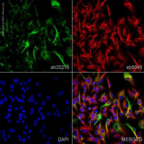Immunocytochemistry/ Immunofluorescence - Anti-Cytokeratin 19 antibody [BA16] (AB20210)