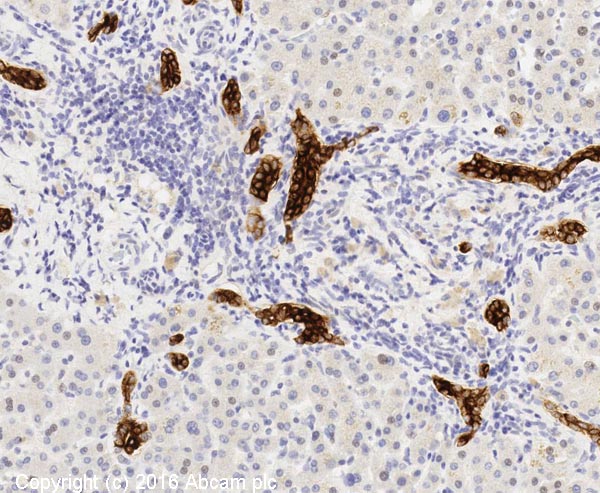 Immunohistochemistry (Formalin/PFA-fixed paraffin-embedded sections) - Anti-Cytokeratin 19 antibody [BA16] (AB20210)