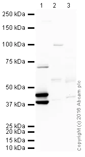 Western blot - Anti-Cytokeratin 19 antibody [BA16] (AB20210)