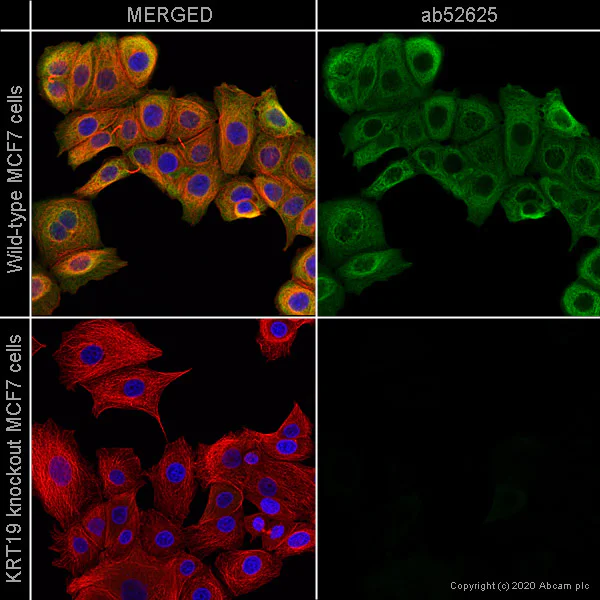 Immunocytochemistry/ Immunofluorescence - Anti-Cytokeratin 19 antibody [EP1580Y] - BSA and Azide free (AB195872)