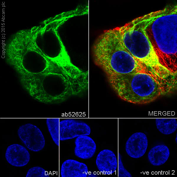 Immunocytochemistry/ Immunofluorescence - Anti-Cytokeratin 19 antibody [EP1580Y] - BSA and Azide free (AB195872)