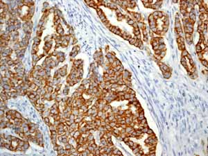 Immunohistochemistry (Formalin/PFA-fixed paraffin-embedded sections) - Anti-Cytokeratin 19 antibody [EP1580Y] - BSA and Azide free (ab195872), expandable thumbnail