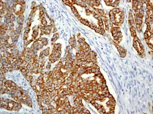 Immunohistochemistry (Formalin/PFA-fixed paraffin-embedded sections) - Anti-Cytokeratin 19 antibody [EP1580Y] - BSA and Azide free (AB195872)
