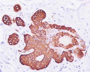Immunohistochemistry (Formalin/PFA-fixed paraffin-embedded sections) - Anti-Cytokeratin 19 antibody [EP1580Y] - BSA and Azide free (ab195872), expandable thumbnail