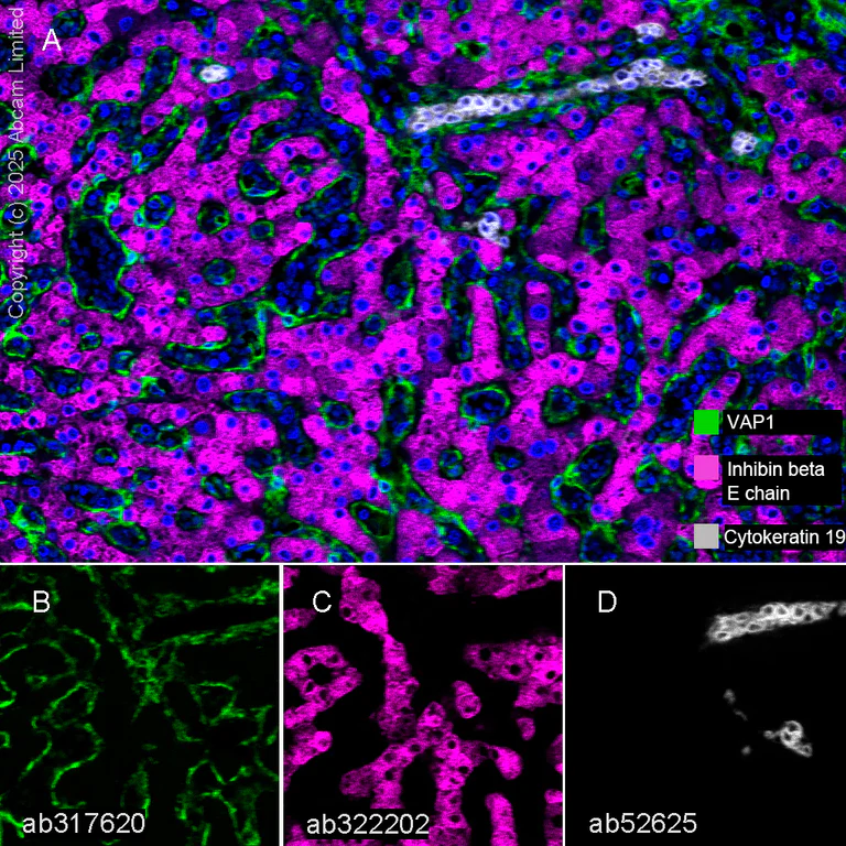 Multiplex immunohistochemistry - Anti-Cytokeratin 19 antibody [EP1580Y] - BSA and Azide free (AB195872)