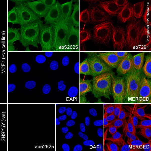 Immunocytochemistry/ Immunofluorescence - Anti-Cytokeratin 19 antibody [EP1580Y] - Cytoskeleton Marker (AB52625)
