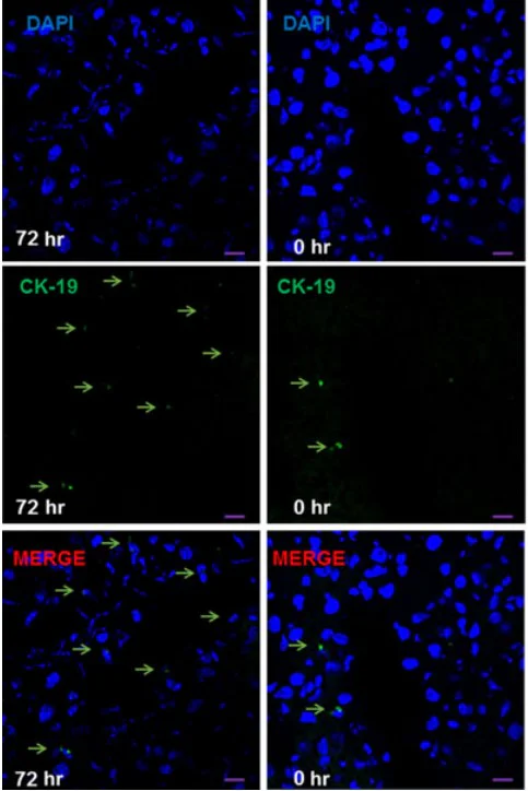 Immunocytochemistry/ Immunofluorescence - Anti-Cytokeratin 19 antibody [EP1580Y] - Cytoskeleton Marker (AB52625)