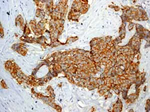 Immunohistochemistry (Formalin/PFA-fixed paraffin-embedded sections) - Anti-Cytokeratin 19 antibody [EP1580Y] - Cytoskeleton Marker (AB52625)