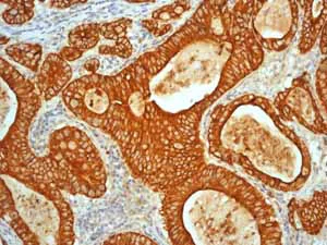 Immunohistochemistry (Formalin/PFA-fixed paraffin-embedded sections) - Anti-Cytokeratin 19 antibody [EP1580Y] - Cytoskeleton Marker (AB52625)
