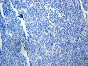 Immunohistochemistry (Formalin/PFA-fixed paraffin-embedded sections) - Anti-Cytokeratin 19 antibody [EP1580Y] - Cytoskeleton Marker (AB52625)