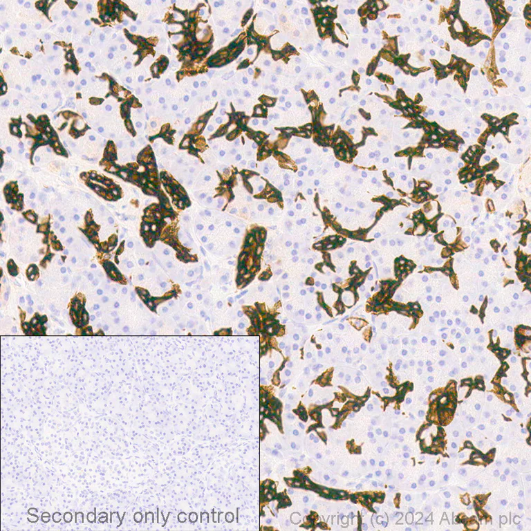 Immunohistochemistry (Formalin/PFA-fixed paraffin-embedded sections) - Anti-Cytokeratin 19 antibody [EP1580Y] - Cytoskeleton Marker (AB52625)