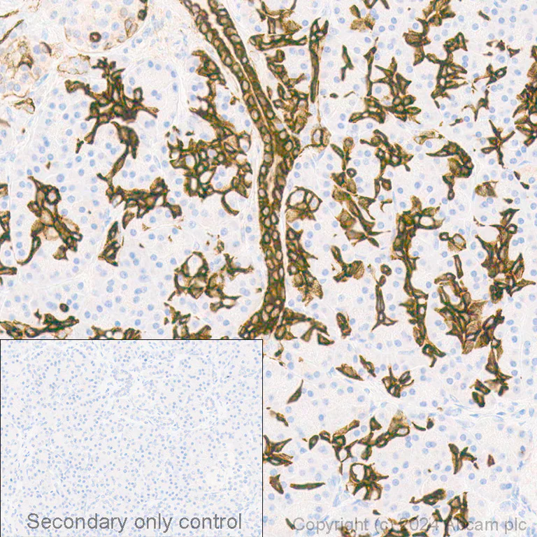 Anti-Cytokeratin 19 抗体 [EP1580Y] - Cytoskeleton Marker (ab52625