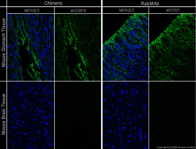 Immunohistochemistry (Formalin/PFA-fixed paraffin-embedded sections) - Anti-Cytokeratin 19 antibody [EP1580Y] - Cytoskeleton Marker (AB52625)