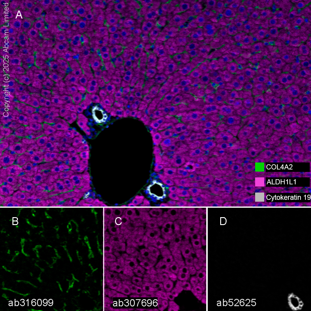 Multiplex immunohistochemistry - Anti-Cytokeratin 19 antibody [EP1580Y] - Cytoskeleton Marker (ab52625), expandable thumbnail