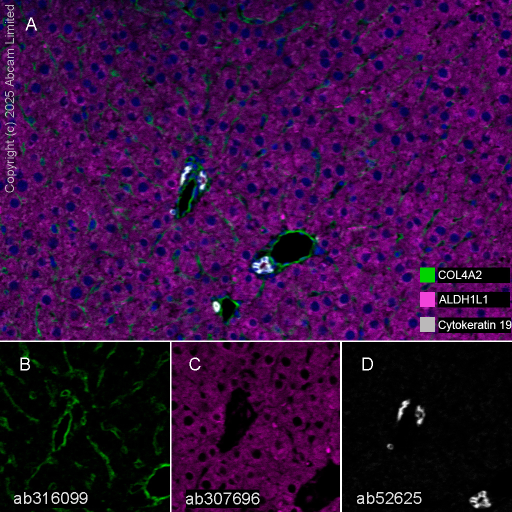 Multiplex immunohistochemistry - Anti-Cytokeratin 19 antibody [EP1580Y] - Cytoskeleton Marker (ab52625), expandable thumbnail