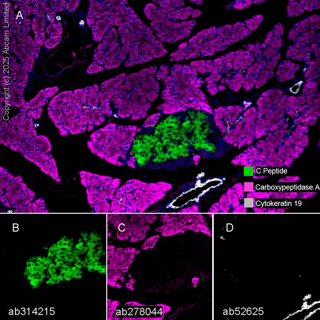 Multiplex immunohistochemistry - Anti-Cytokeratin 19 antibody [EP1580Y] - Cytoskeleton Marker (ab52625), expandable thumbnail